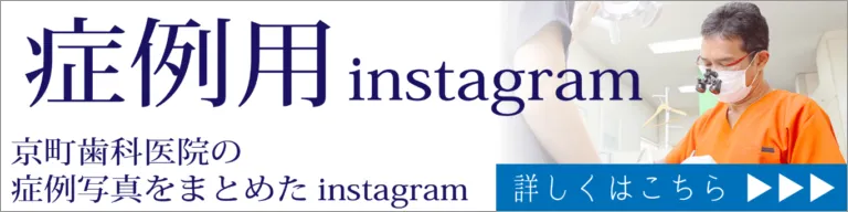 Instagramer