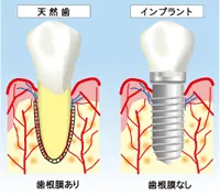 できる限り“歯は抜きません”